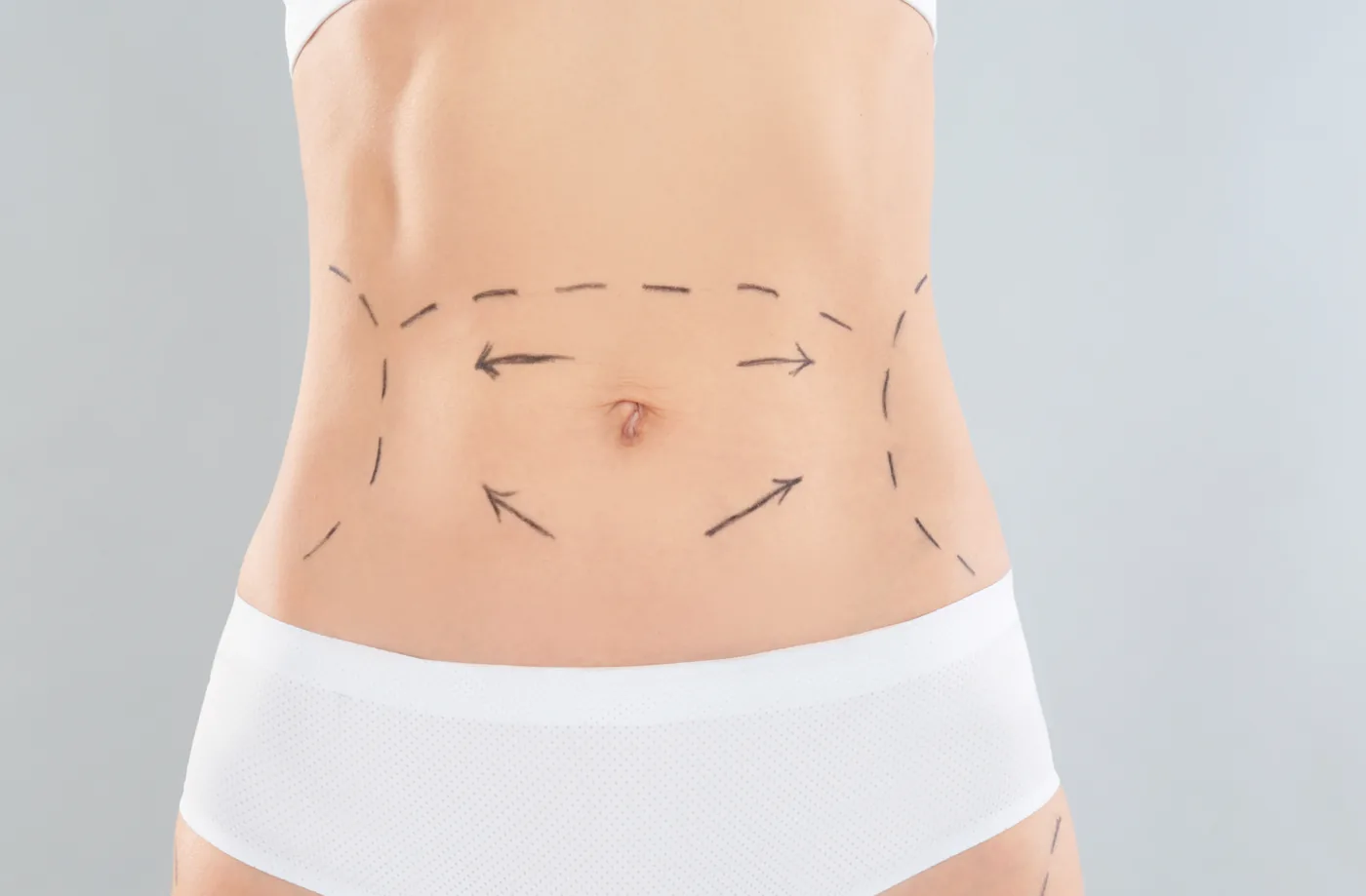 Targeting stubborn localized fat on the tummy and flanks